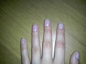 Ongemanicuurde nagels? Not done.